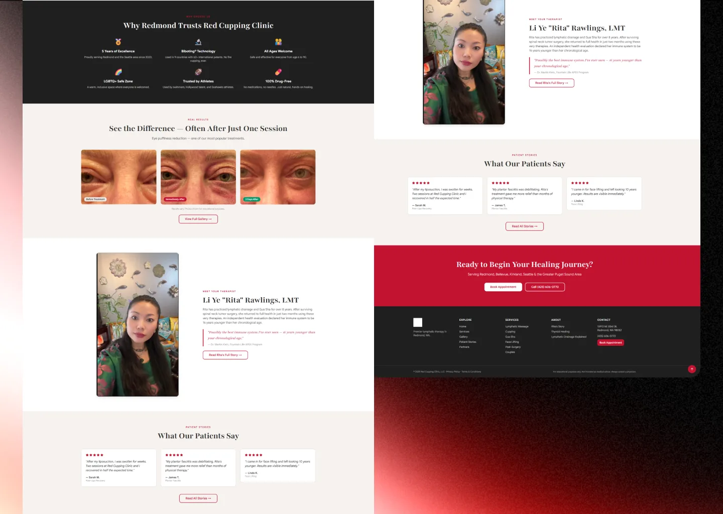 Red Cupping Clinic why-choose-us grid with six icons, a labelled three-stage treatment photo comparison, the therapist introduction and patient stories